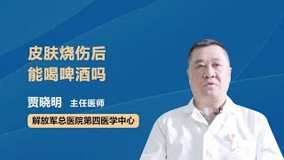 皮肤烧伤后能喝啤酒吗 贾晓明 中国人民解放军总医院第一附属304医院