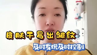 皮肤干易出皱纹，你要及时发现及时控制，这样做更简单！