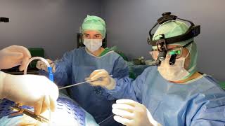 Minimally Invasive Mitral Valve Surgery