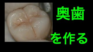 how to make a tooth　歯の作り方