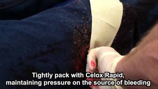 Celox Rapid Haemostatic Z-Fold Gauze