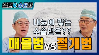 매몰법vs절개법, 어떤방법이 좋을까? [열린수신함 59]