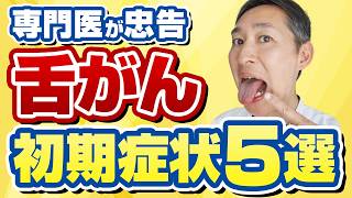 放置危険、治らない口内炎と舌がんの簡単な見分け方