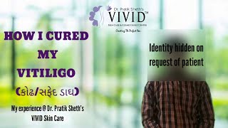 How I Cured My Vitiligo (કોઢ / સફેદ ડાઘ)