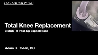 3 Month Post-Op Total Knee Replacement -Expectations and Answers to what is normal following surgery