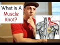 What is a Muscle Knot?