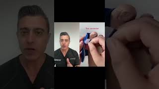 Bunion Corrector! Does it works?