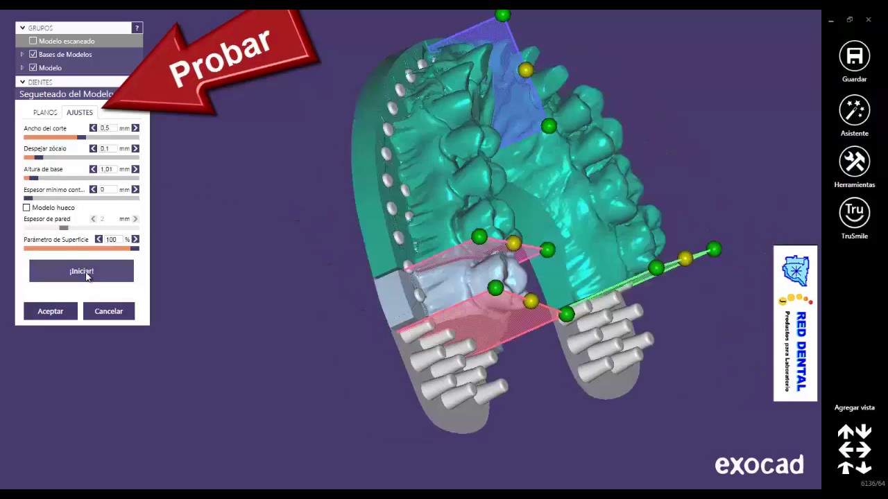 Exocad Model Creator Red Dental Metodo 1 - YouTube