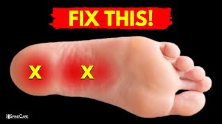How to Relieve PLANTAR FASCIITIS Pain in Seconds