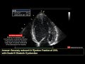 echocardiography case 124 echo spot diagnosis case series heart