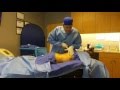 Liposuction Demonstration-Laser Lipo Demonstration Part 1 of 6