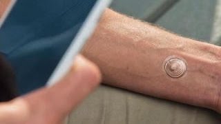 CNET Update - Unlock your phone with Motorola's 'digital tattoo'