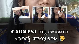 carmesi natural roll on വാങ്ങിയ എന്റെ അവസ്ഥ 😮👆🏻😪