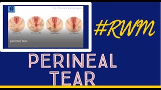 Perineal tear Classification | NEETPG | AIIMS | FMGE| Obgy | Dr.Nikita Nanwani