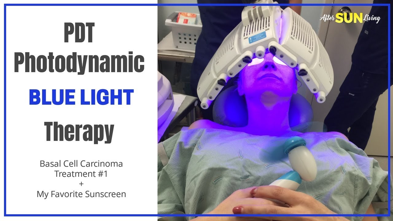 PDT PHOTODYNAMIC BLUE LIGHT THERAPY | Skin Cancer Treatment | Basal ...