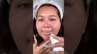 Microdermabrasion at Home with MIO