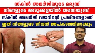 സ്‌കിൻ അലർജി വയറിൻറെ പ്രശ്‌നങ്ങളാണ് ഇത് നിങ്ങളുടെ ജീവൻ അപകടത്തിലാക്കും