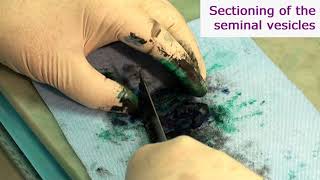 Gross Examination Whole Prostatectomy Specimens BRIEF