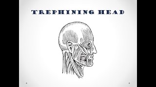 Thing of the Month #5: Trephining Head - Barts Health Archives