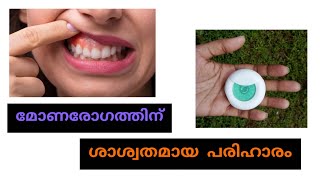 easy way to prevent gum disease / മോണരോഗം തടയാനുള്ള എളുപ്പവഴി | thermoseal waxed dental floss review