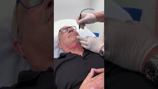 Zmed facial laser lipolysis and tightening