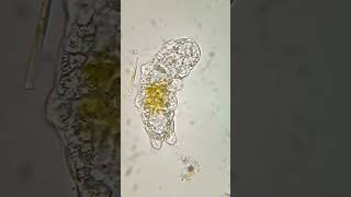 Water bear living in a forest wetland #biologist #biology #microscope #waterbears