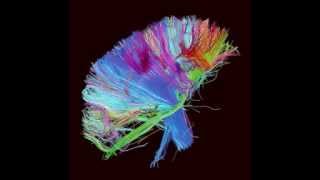 MUSE - Panic Station [The 2nd Law]