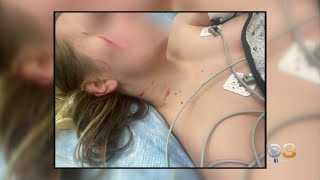 Woman Brutally Attacked By Another Woman In North Philadelphia Shares Horrifying Experience