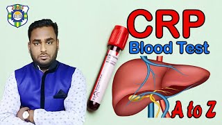 C Reactive protein test | CRP Test | সি রেকটিভ প্রোটিন রক্ত পরীক্ষা | CRP Rakta pariksha.