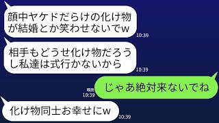 結婚式当日、やけどの跡を見た義姉夫婦が「化け物には祝儀を渡したくない」と言って、私の結婚式への出席を断った。