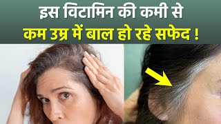 Which Vitamin Deficiency Causes White Hair: Kis Vitamin Ki Kami Se Baal Safed Hote Hain ?