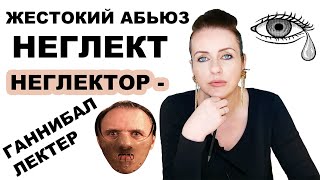 НЕГЛЕКТ - СКРЫТАЯ АГРЕССИЯ. Вас едят живьём.