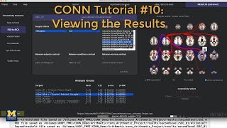 CONN Tutorial #10: Viewing the Results