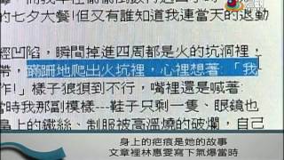 高雄氣爆一週年 女警分享復健心路歷程—宏觀粵語新聞