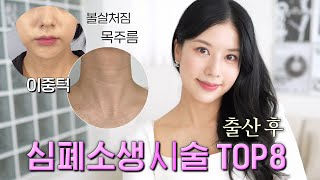 출산 후, 심폐소생 시술 𝗧𝗢𝗣𝟴 💉( 목주름, 이중턱, 볼살처짐 완벽해결?! )