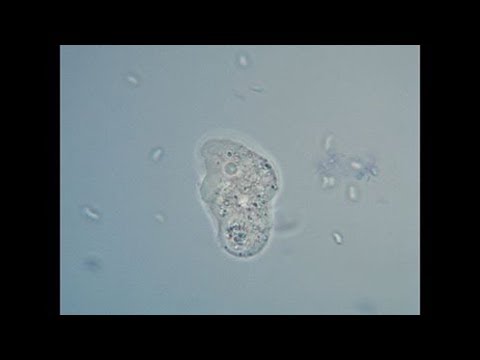 What magnification do you need to see amoeba?