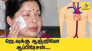 Grave Situation : Jayalalitha given external heart assistance device | Latest Tamil Nadu CM News