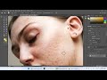 cách xóa mụn nhặt mụn và làm mịn da tốt nhất trong photoshop bằng công cụ ai