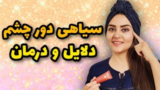 دلایل تیرگی دور چشم و درمان سیاهی زیر چشم با یوگای صورت 💯