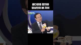 뼈에 구멍이 생기는 골다공증