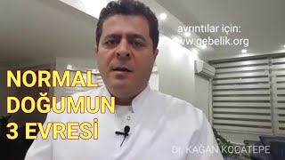 Normal doğumun 3 aşaması (rahim ağzı açılması, bebeğin ıkınmayla doğması ve plasentanın çıkması)