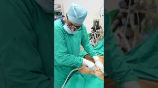 Liposuction Surgery #abdomen #tummy #shorts #ytshort