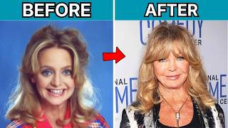 20 Celebrities Before and After Cosmetic Surgery