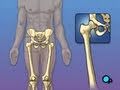 Hip Replacement Surgery PreOp® Patient Education