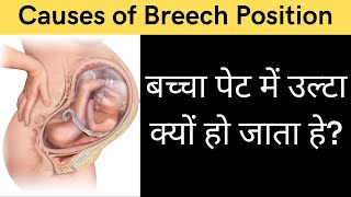 बच्चा गर्भ में उल्टा क्यों हो जाता हे? | Breech position | transverse position