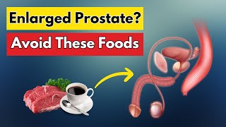 Top 10 Most Harmful Foods For Prostate