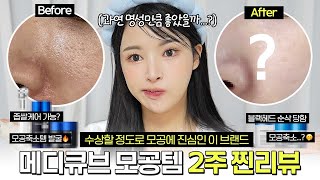 광고 속 모공템..구라아냐❓3주간 싹 다 써봤어요-리뷰🤔