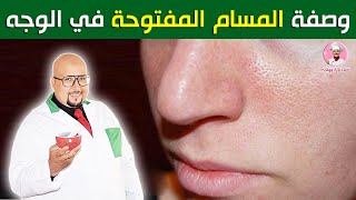 وصفة لمشكل المسام المفتوحة في الوجه من عند الدكتور عماد ميزاب