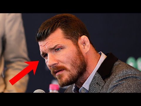 We Need To Know WHAT Really Happened With Micheal Bisping’s Eye ...