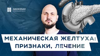 Механическая желтуха: с чем связана и чем опасна? Hadassah Medical Moscow